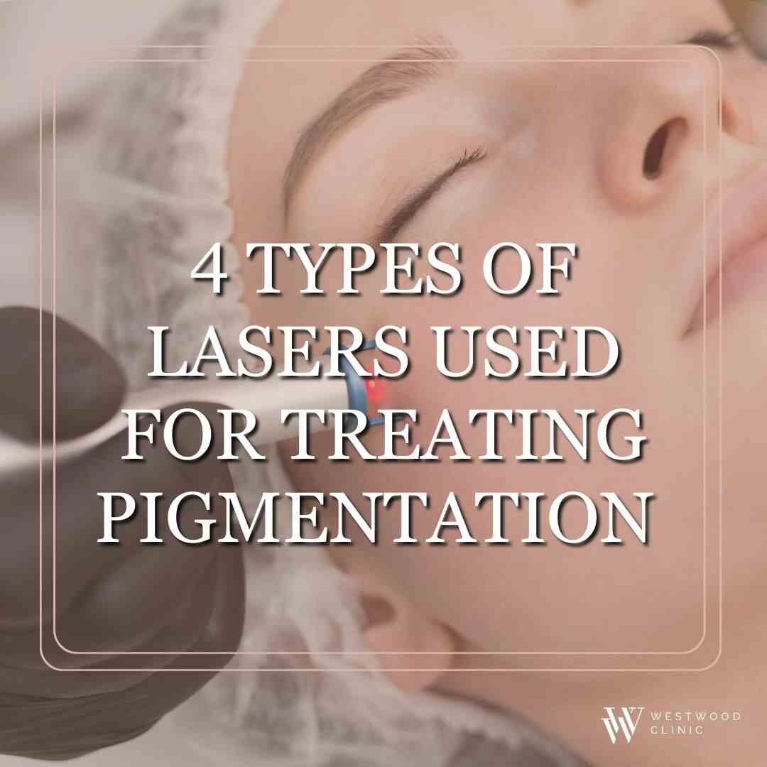 laser for pigmentation