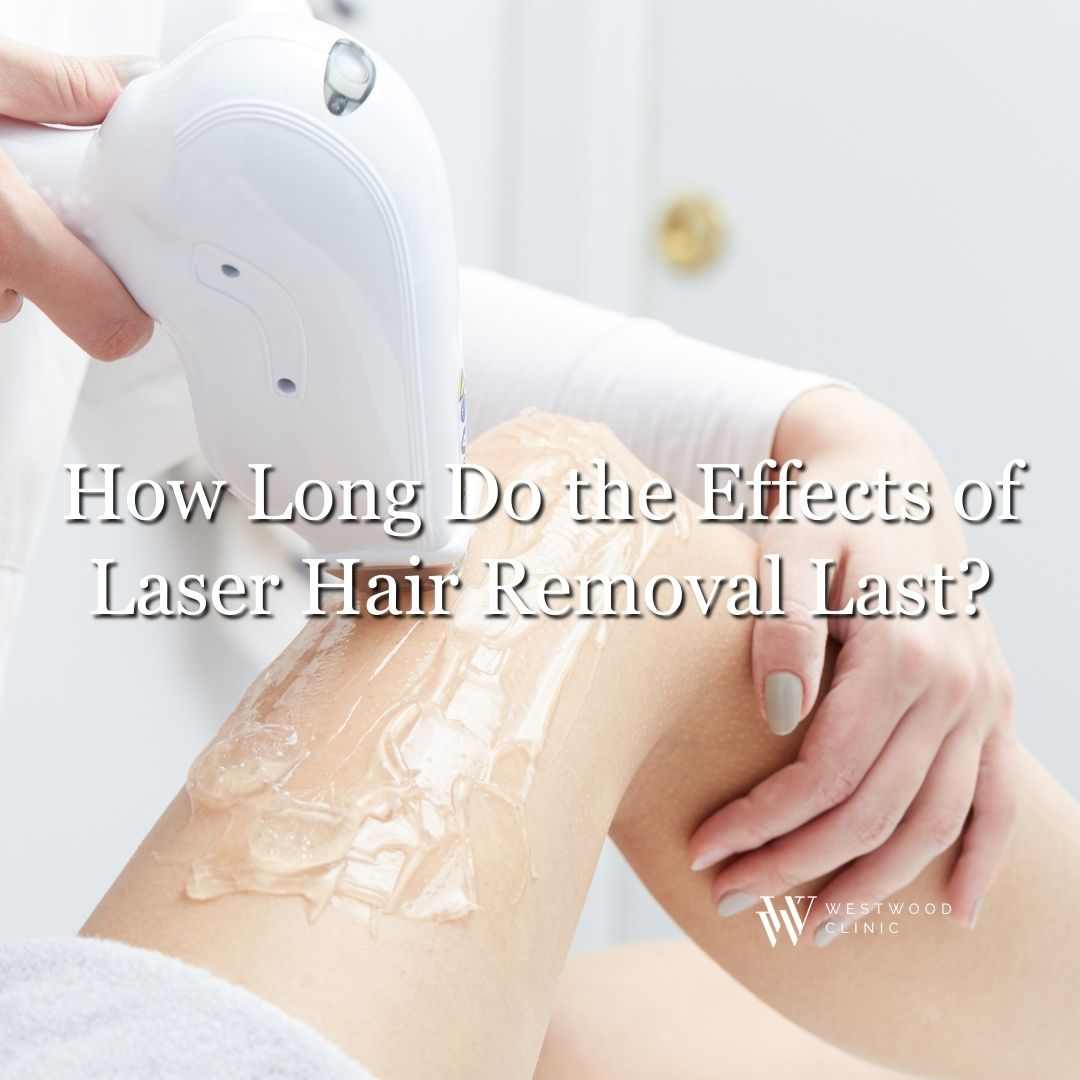 laser hair removal near me