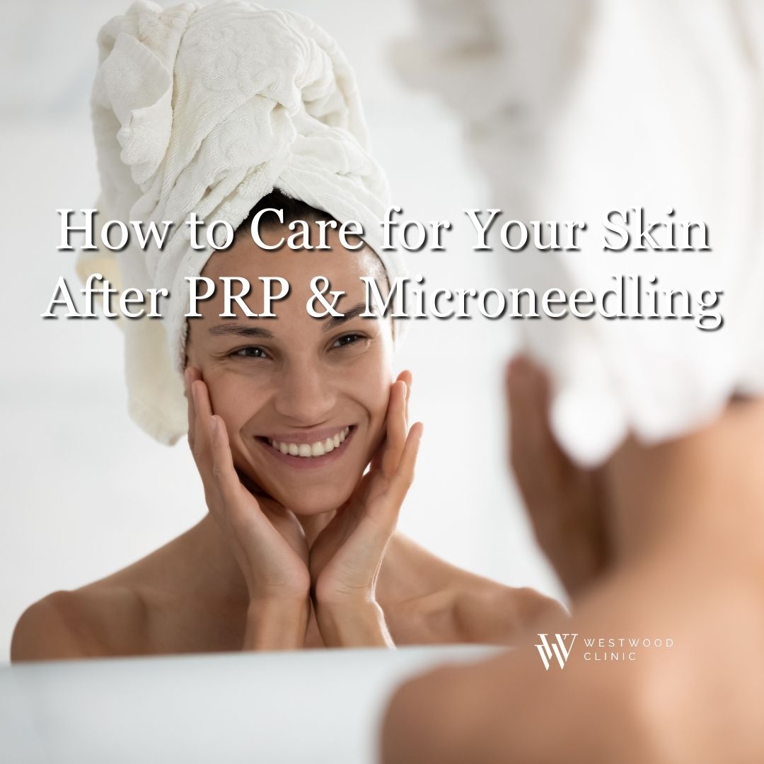 prp and microneedling