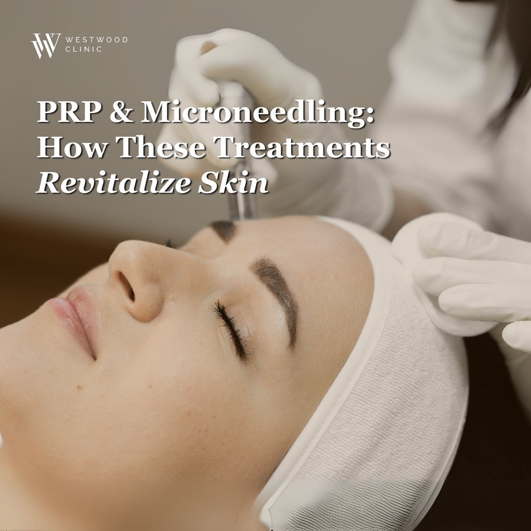 prp and microneedling